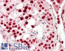 DNAJB8 Antibody - Human Testis: Formalin-Fixed, Paraffin-Embedded (FFPE)