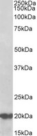 DNAJC5 / CSP Antibody - DNAJC5 antibody (0.5 ug/ml) staining of Human Cerebellum lysate (35 ug protein in RIPA buffer). Primary incubation was 1 hour. Detected by chemiluminescence.