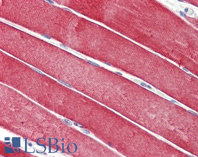 DNAJC5 / CSP Antibody - Anti-DNAJC5 / CSP antibody IHC staining of human skeletal muscle. Immunohistochemistry of formalin-fixed, paraffin-embedded tissue after heat-induced antigen retrieval. Antibody concentration 5 ug/ml.