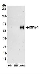 DNAM-1 / CD226 Antibody - Detection of Human DNAM-1 by Western Blot. Samples: Whole cell lysate (50 ug) prepared using NETN buffer from HeLa, 293T, and Jurkat cells. Antibodies: Affinity purified rabbit anti-DNAM-1 antibody used for WB at 0.1 ug/ml. Detection: Chemiluminescence with an exposure time of 3 minutes.