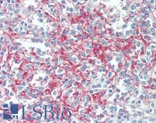 DNAM-1 / CD226 Antibody - Human Spleen: Formalin-Fixed, Paraffin-Embedded (FFPE)