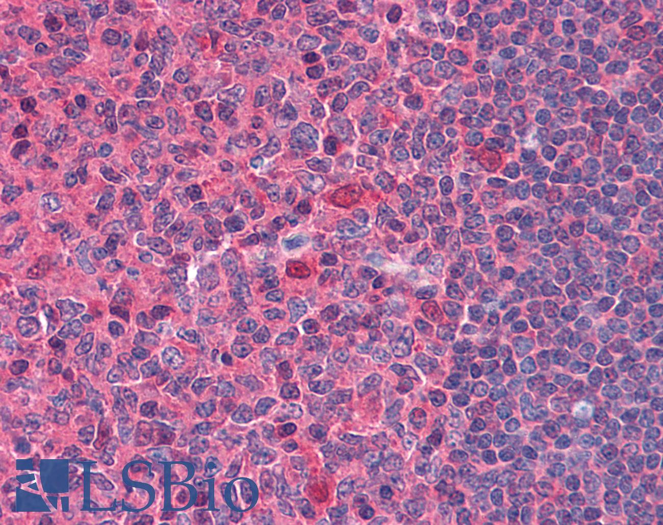 DNASE1 / DNase I Antibody - Anti-DNase I antibody IHC of human tonsil. Immunohistochemistry of formalin-fixed, paraffin-embedded tissue after heat-induced antigen retrieval. Antibody concentration 10 ug/ml.