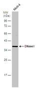 DNASE1 / DNase I Antibody - Western blot using MOLT-4 cell extracts. Antibody diluted 1:1000