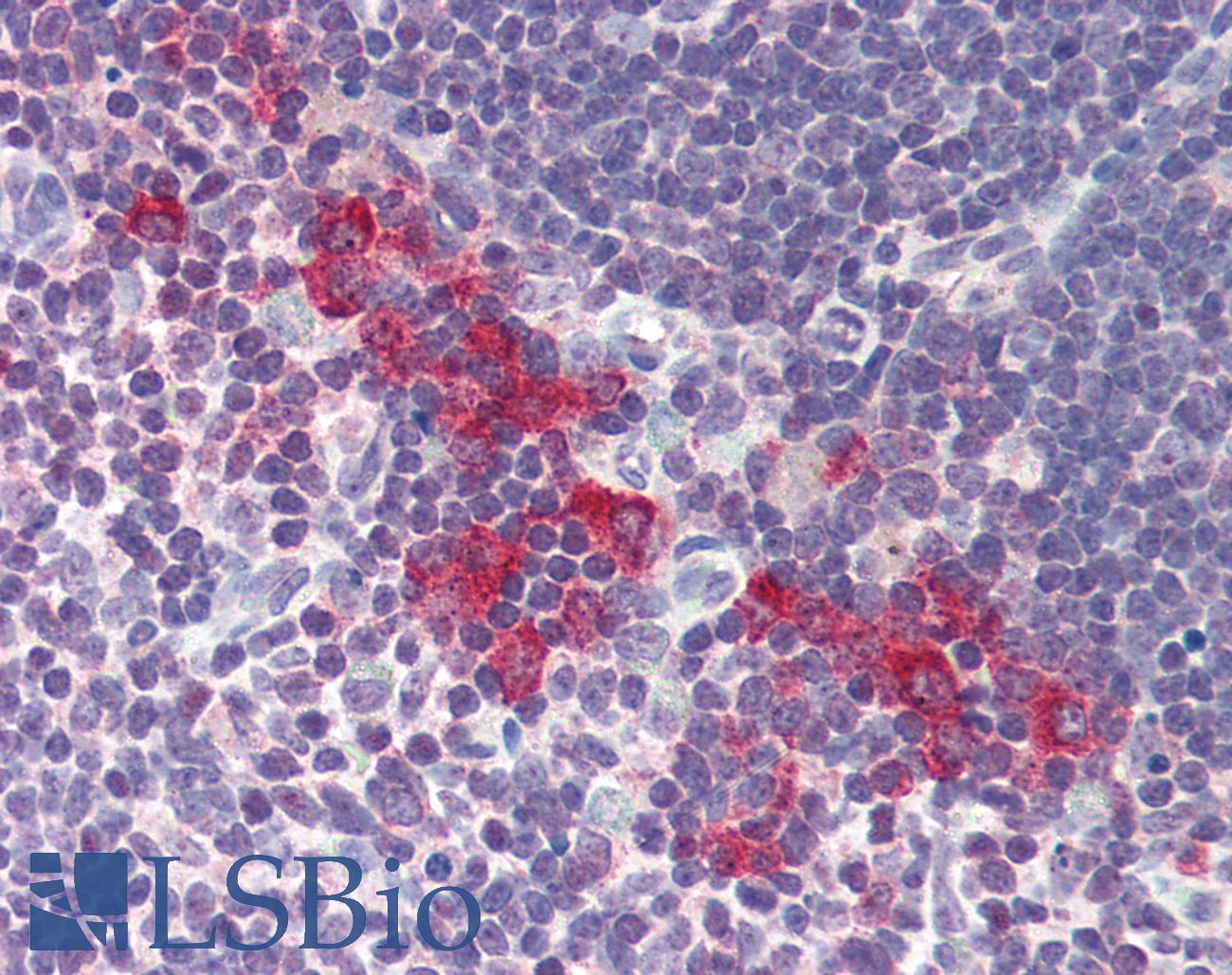 DNASE2 / DNase II Antibody - Anti-DNASE2 / DNase II antibody IHC of human thymus. Immunohistochemistry of formalin-fixed, paraffin-embedded tissue after heat-induced antigen retrieval. Antibody concentration 5 ug/ml.