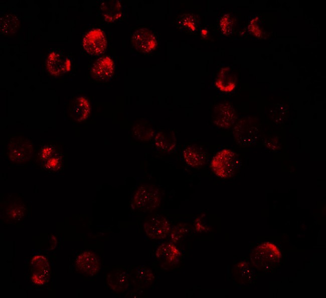DNM1L / DRP1 Antibody - Immunofluorescence of DNM1L in HeLa cells with DNM1L antibody at 20 µg/mL.