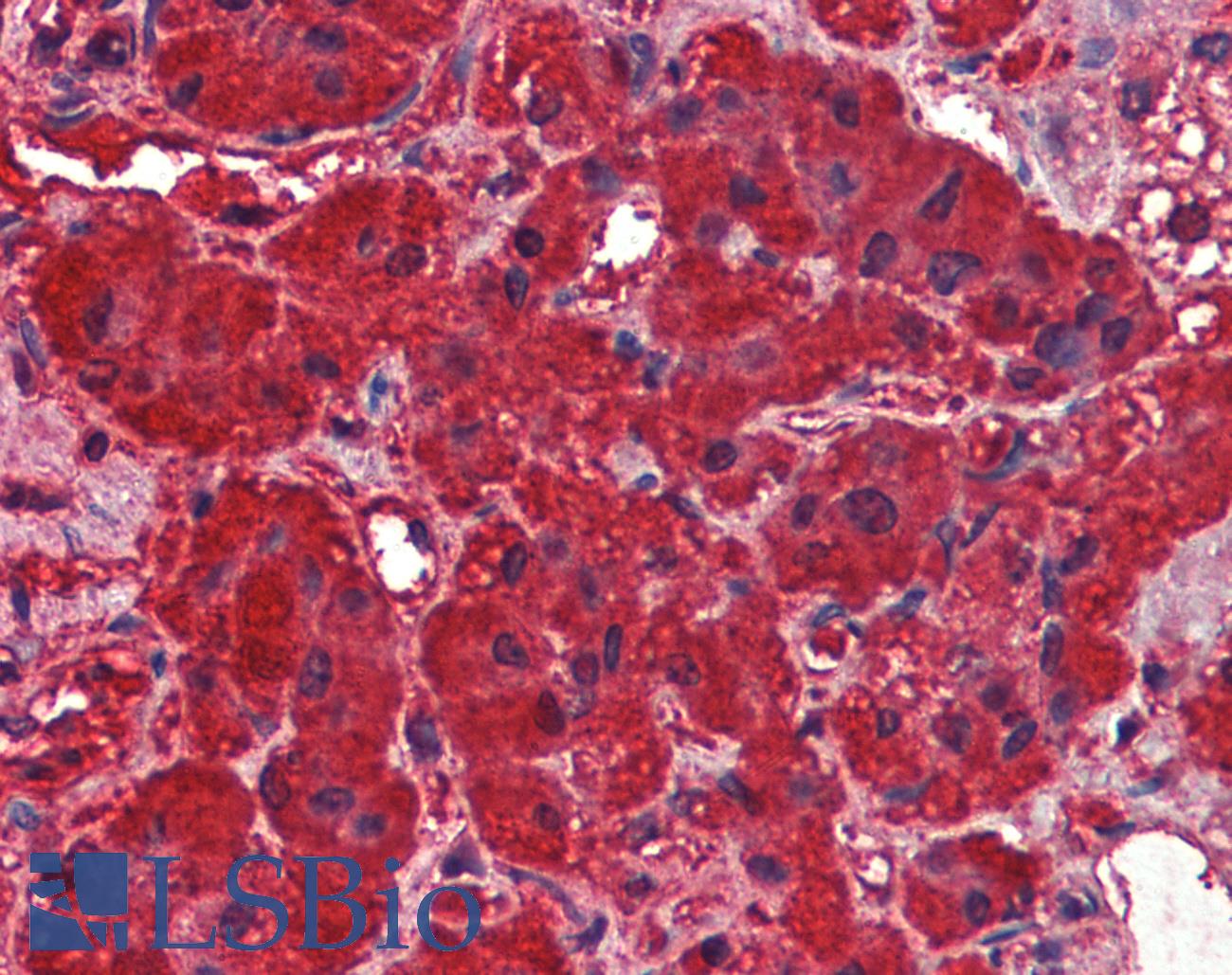 DNM3 / Dynamin 3 Antibody - Anti-DNM3 / Dynamin-3 antibody IHC of human adrenal. Immunohistochemistry of formalin-fixed, paraffin-embedded tissue after heat-induced antigen retrieval. Antibody concentration 2.5 ug/ml.