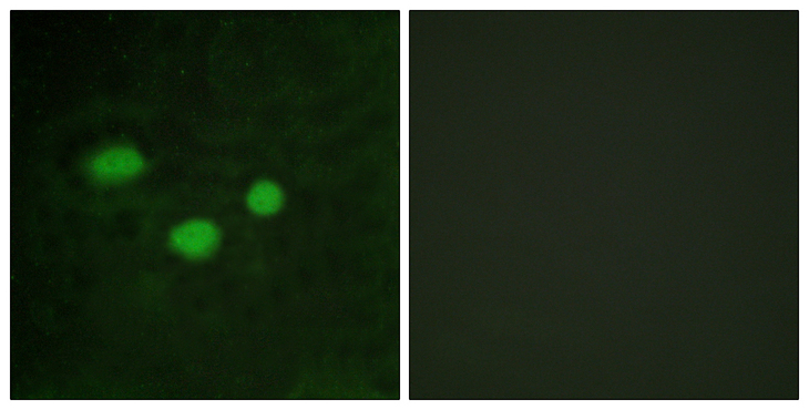 DNMT3B Antibody - Immunofluorescence analysis of HeLa cells, using DNMT3B Antibody. The picture on the right is blocked with the synthesized peptide.