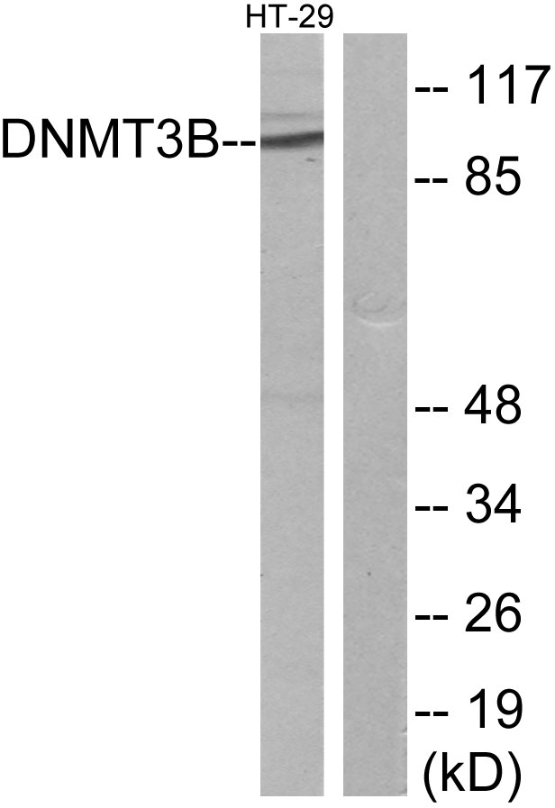 DNMT3B Antibody - Western blot analysis of lysates from HT-29 cells, using DNMT3B Antibody. The lane on the right is blocked with the synthesized peptide.