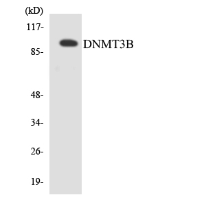 DNMT3B Antibody - Western blot analysis of the lysates from HeLa cells using DNMT3B antibody.