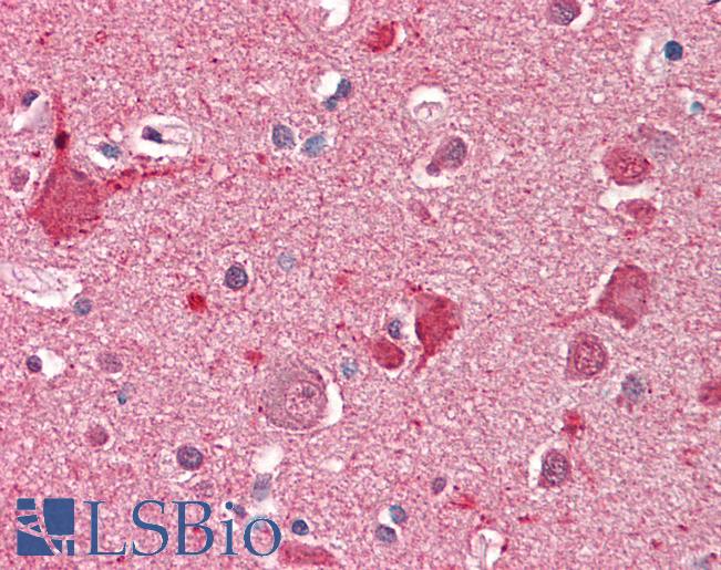 DOC2A Antibody - Anti-DOC2A antibody IHC staining of human brain, cortex. Immunohistochemistry of formalin-fixed, paraffin-embedded tissue after heat-induced antigen retrieval. Antibody concentration 5 ug/ml.