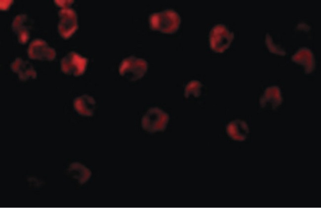 DOK1 Antibody - Immunofluorescence of DOK1 in K562 cells with DOK1 antibody at 10 ug/ml.