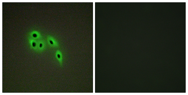 DOK6 Antibody - Immunofluorescence analysis of A549 cells, using DOK6 Antibody. The picture on the right is blocked with the synthesized peptide.