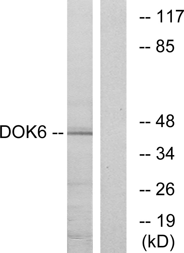DOK6 Antibody - Western blot analysis of lysates from COLO cells, using DOK6 Antibody. The lane on the right is blocked with the synthesized peptide.