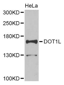 DOT1L / DOT1 Antibody - Western blot of extracts of HeLa cell line, using DOT1L antibody.