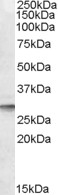 DPM1 Antibody - DPM1 antibody (0.1µg/ml) staining of Human Liver lysate (35µg protein in RIPA buffer). Detected by chemiluminescence.