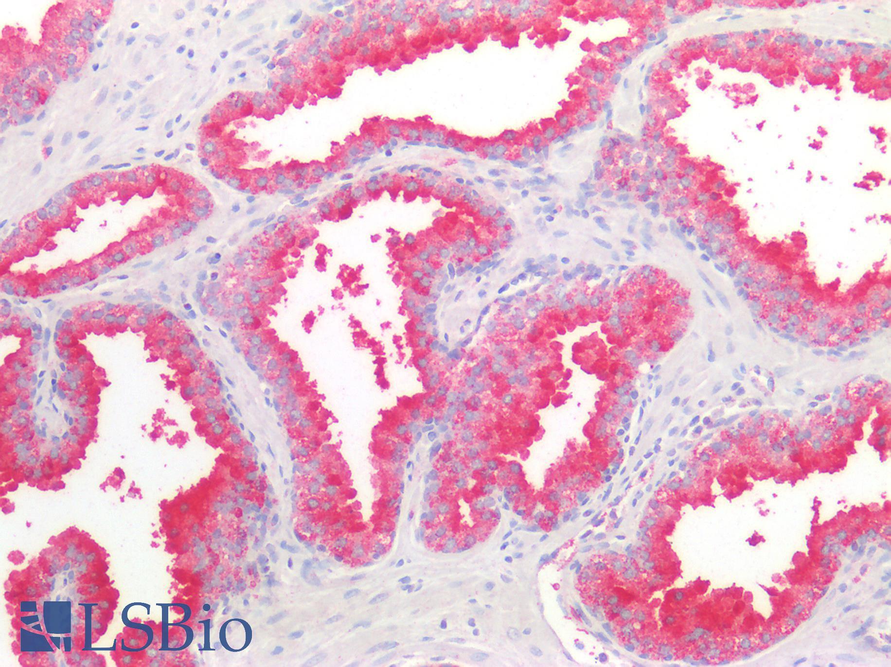 DPP4 / CD26 Antibody - Human Prostate: Formalin-Fixed, Paraffin-Embedded (FFPE)
