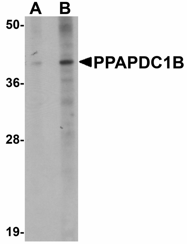 DPPL1 / PPAPDC1B Antibody - Western blot of PPAPDC1B in EL4 cell lysate with PPAPDC1B antibody at (A) 1 and (B) 2 ug/ml.