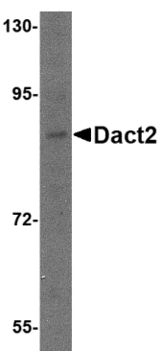 DPR2 / DACT2 Antibody - Western blot of Dact2 in SK-N-SH cell lysate with Dact2 antibody at 1 ug/ml.