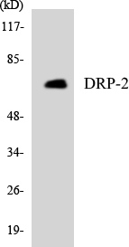 DPYSL2 / CRMP2 Antibody - Western blot analysis of the lysates from HepG2 cells using DRP-2 antibody.