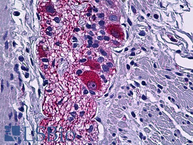 DPYSL2 / CRMP2 Antibody - Anti-CRMP-2 antibody IHC of human colon, peripheral nerve. Immunohistochemistry of formalin-fixed, paraffin-embedded tissue after heat-induced antigen retrieval. Antibody dilution 1:100.