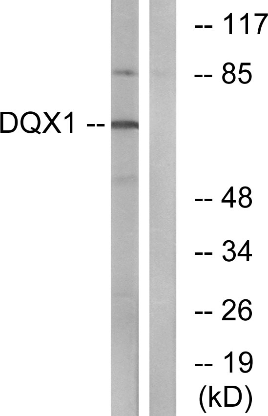 DQX1 Antibody - Western blot analysis of lysates from COS7 cells, using DQX1 Antibody. The lane on the right is blocked with the synthesized peptide.