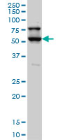 DRAK1 / STK17A Antibody - STK17A monoclonal antibody clone 4D12 Western blot of STK17A expression in HepG2.