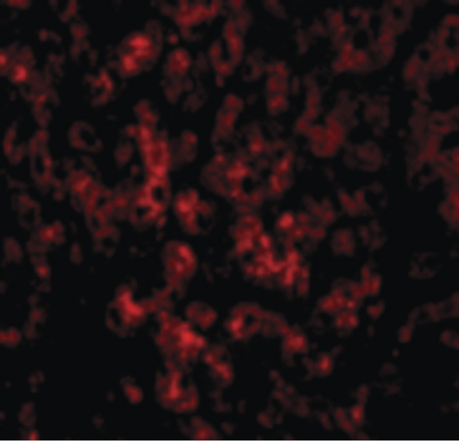 DRAM1 / DRAM Antibody - Immunofluorescence of DRAM in Human Liver cells with DRAM antibody at 20 ug/ml.