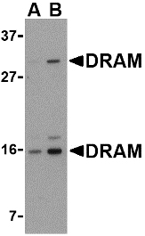 DRAM1 / DRAM Antibody - Western blot of DRAM in 293 cell lysate with DRAM antibody at (A) 0.5 and (B) 1 ug/ml.