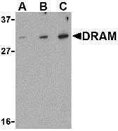 DRAM1 / DRAM Antibody - Western blot of DRAM in K562 cell lysate with DRAM antibody at (A) 0.5, (B) 1 and (C) 2 ug/ml.