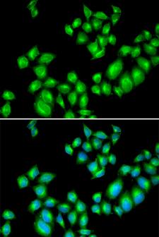 DRD3 / Dopamine Receptor D3 Antibody - Immunofluorescence analysis of U2OS cells using DRD3 antibody. Blue: DAPI for nuclear staining.