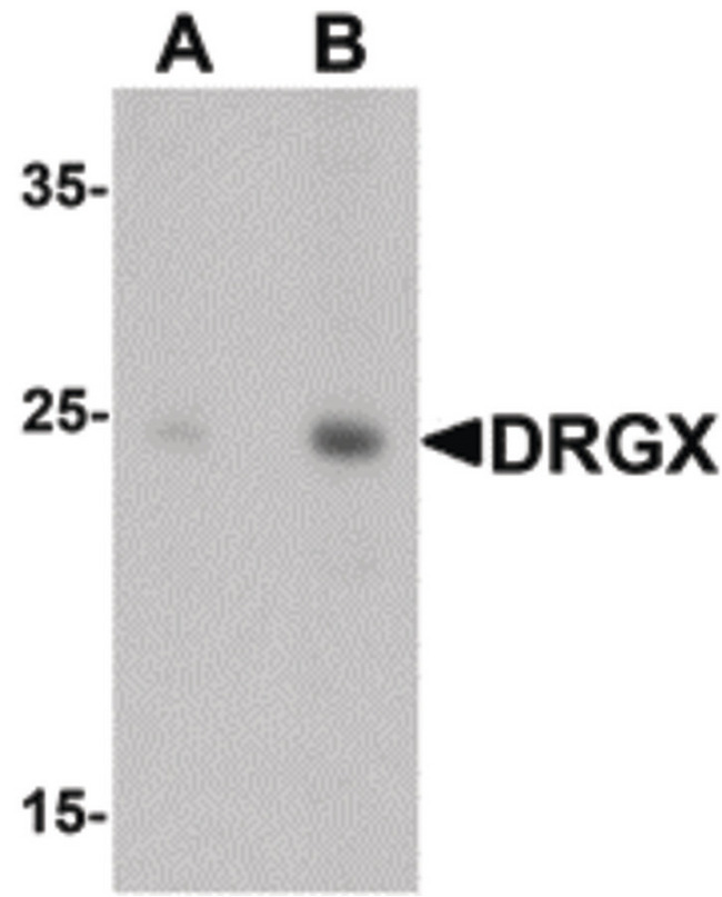 DRGX Antibody - Western blot of DRGX in rat liver tissue lysate with DRGX antibody at (A) 1 and (B) 2 ug/ml.