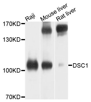 DSC1 / Desmocollin 1 Antibody - Western blot analysis of extracts of various cell lines, using DSC1 antibody at 1:1000 dilution. The secondary antibody used was an HRP Goat Anti-Rabbit IgG (H+L) at 1:10000 dilution. Lysates were loaded 25ug per lane and 3% nonfat dry milk in TBST was used for blocking. An ECL Kit was used for detection and the exposure time was 30s.