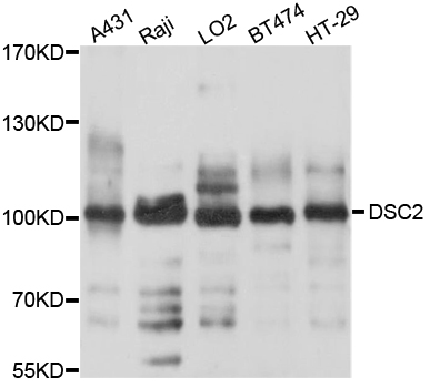 DSC2 / Desmocollin 2 Antibody - Western blot analysis of extracts of various cell lines, using DSC2 antibody at 1:1000 dilution. The secondary antibody used was an HRP Goat Anti-Rabbit IgG (H+L) at 1:10000 dilution. Lysates were loaded 25ug per lane and 3% nonfat dry milk in TBST was used for blocking. An ECL Kit was used for detection and the exposure time was 5s.
