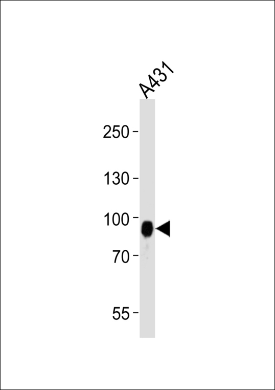 DSC3 / Desmocollin 3 Antibody - Western blot of lysate from A431 cell line, using DSC3 Antibody. Antibody was diluted at 1:1000 at each lane. A goat anti-rabbit IgG H&L (HRP) at 1:5000 dilution was used as the secondary antibody. Lysate at 35ug per lane.