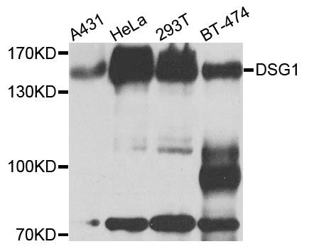 DSG1 / Desmoglein 1 Antibody - Western blot analysis of extracts of various cells.