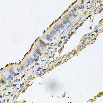 DSG1 / Desmoglein 1 Antibody - Immunohistochemistry of paraffin-embedded human trachea tissue.