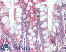 DSG2 / Desmoglein 2 Antibody - Human Small Intestine: Formalin-Fixed, Paraffin-Embedded (FFPE)