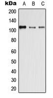 DSG4 / Desmoglein 4 Antibody - Western blot analysis of Desmoglein 4 expression in HEK293T (A); SP2/0 (B); H9C2 (C) whole cell lysates.