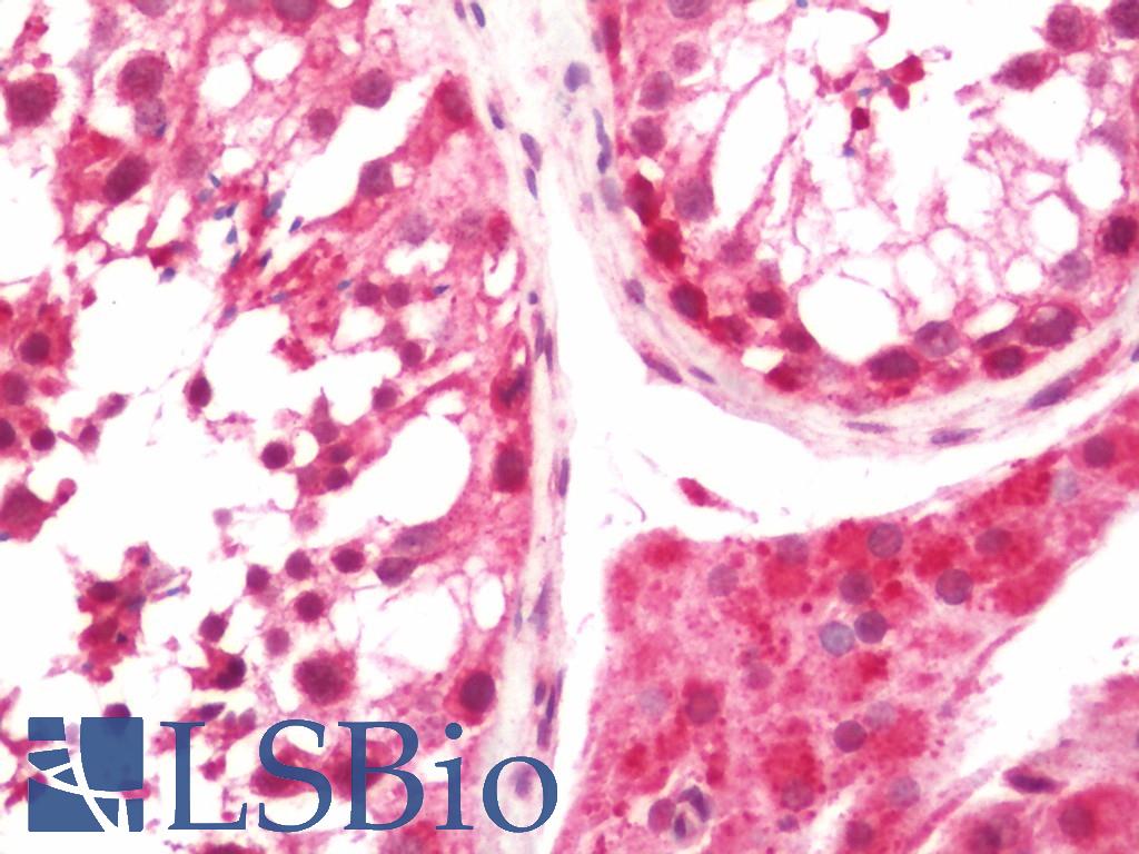 DTWD1 Antibody - Human Testis: Formalin-Fixed, Paraffin-Embedded (FFPE).  This image was taken for the unconjugated form of this product. Other forms have not been tested.
