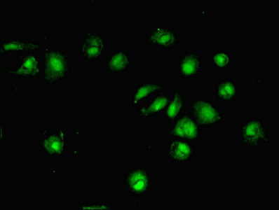DTWD1 Antibody - Immunofluorescent analysis of MCF-7 cells using DTWD1 Antibody at dilution of 1:100 and Alexa Fluor 488-congugated AffiniPure Goat Anti-Rabbit IgG(H+L)