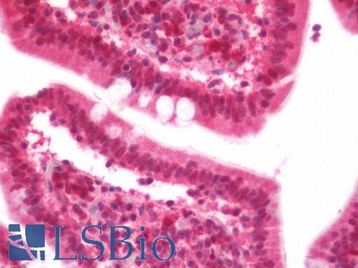 DTX4 Antibody - Human Small Intestine: Formalin-Fixed, Paraffin-Embedded (FFPE)