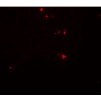 DTX4 Antibody - Immunofluorescence of DTX4 in human spleen tissue with DTX4 antibody at 20 µg/ml.