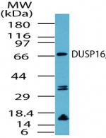 DUSP16 / MKP7 Antibody - Western blot of human DUSP16? in Jurkat cell lysate using antibody at 2 ug/ml.