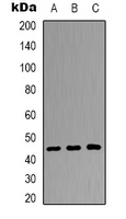 DUSP4 / MKP2 Antibody - Western blot analysis of DUSP4 expression in HepG2 (A); HEK293T (B); NIH3T3 (C) whole cell lysates.