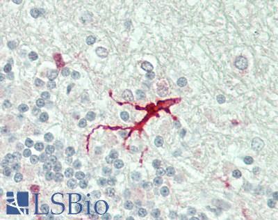 DUSP4 / MKP2 Antibody - Human Brain, Cerebellum: Formalin-Fixed, Paraffin-Embedded (FFPE)