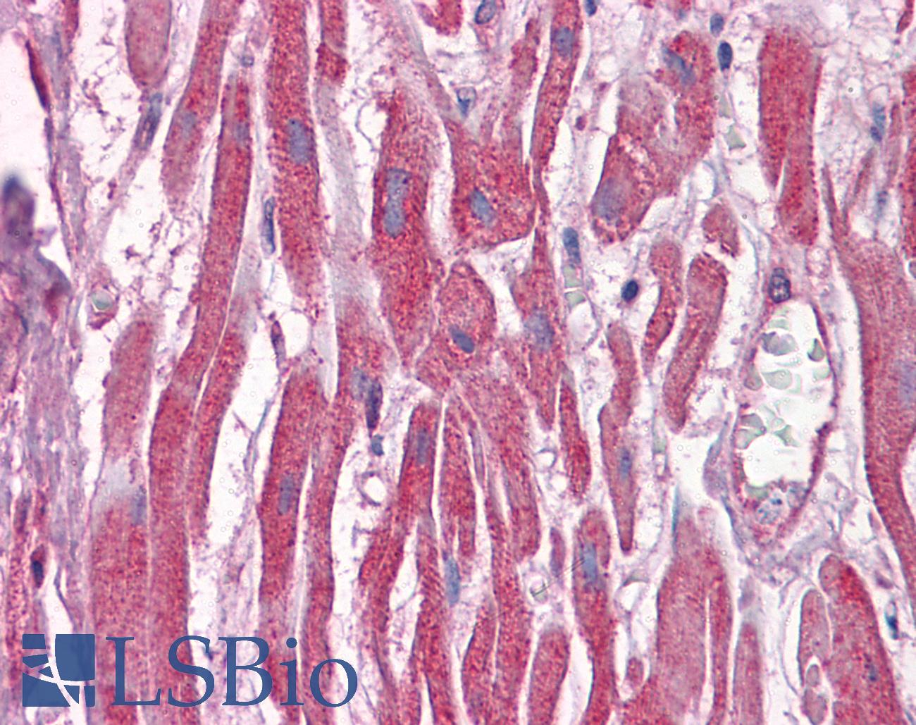 DUSP6 / MKP3 Antibody - Anti-DUSP6 antibody IHC of human heart. Immunohistochemistry of formalin-fixed, paraffin-embedded tissue after heat-induced antigen retrieval. Antibody concentration 5 ug/ml.