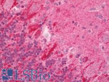 DUSP9 Antibody - Human Brain, Cerebellum: Formalin-Fixed, Paraffin-Embedded (FFPE) 
