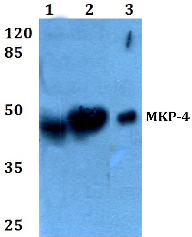 DUSP9 Antibody - Western blot analysis of Anti-DUSP9 Antibody at 1:500 dilution. Lane 1: HEK293T whole cell lysate. Lane 2: H9C2 whole cell lysate. Lane 3: PC12 whole cell lysate.