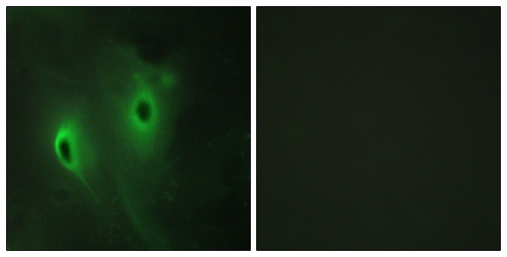 DUSP9 Antibody - Immunofluorescence analysis of HeLa cells, using DUSP9 Antibody. The picture on the right is blocked with the synthesized peptide.