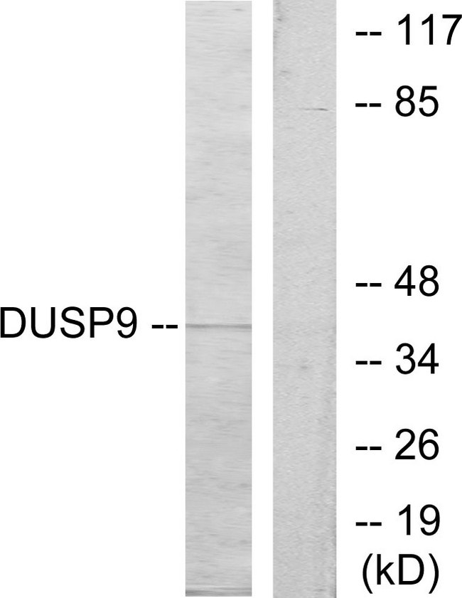 DUSP9 Antibody - Western blot analysis of lysates from HeLa cells, using DUSP9 Antibody. The lane on the right is blocked with the synthesized peptide.